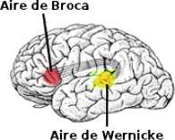 broca-wernicke