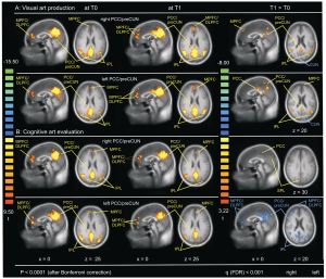 journal.pone.0101035.g001
